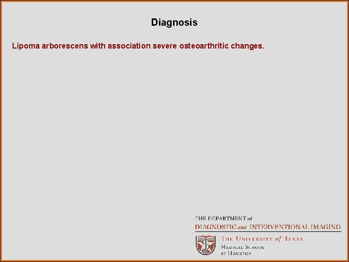 Diagnosis Lipoma arborescens with association severe osteoarthritic changes. 