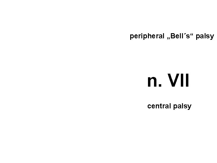 peripheral „Bell´s“ palsy n. VII central palsy 