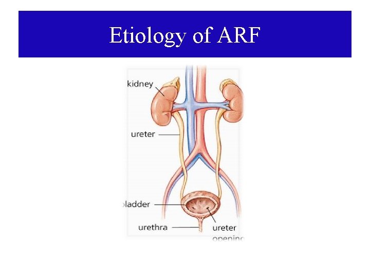 Etiology of ARF Etiology of ARF