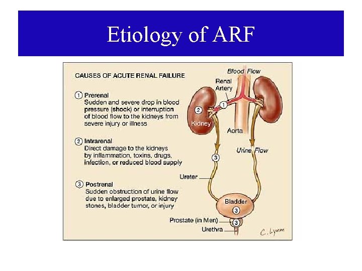 Etiology of ARF 