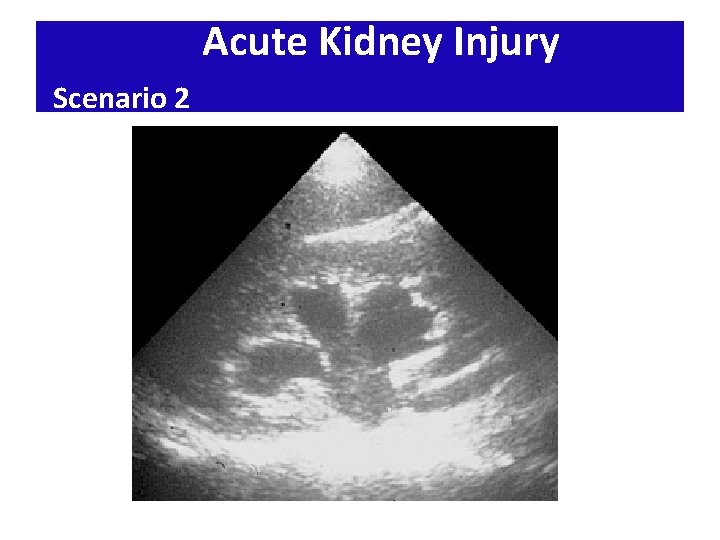 Acute Kidney Injury Scenario 2 Acute Kidney Injury Scenario 2