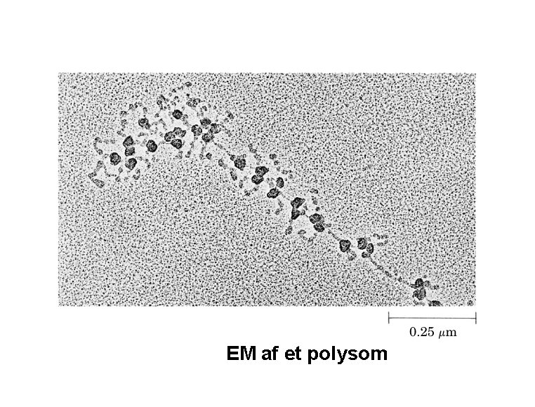 EM af et polysom 