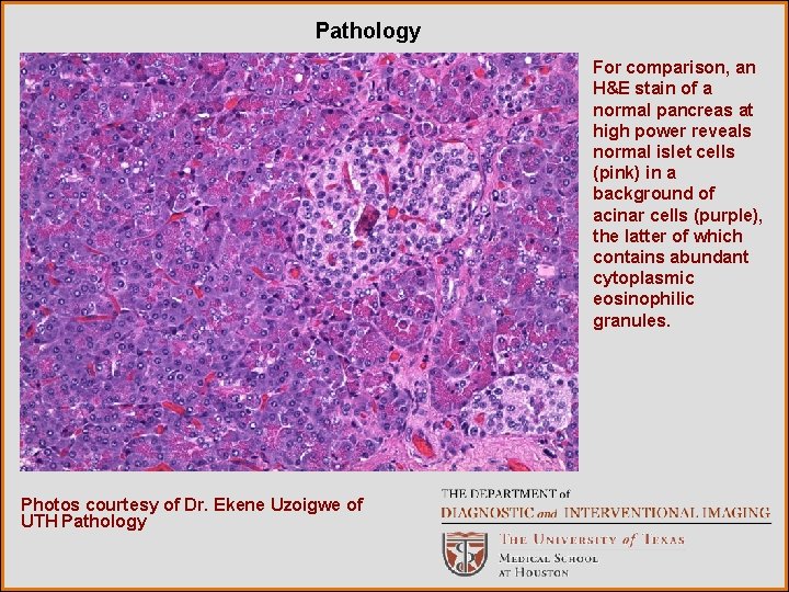 Pathology For comparison, an H&E stain of a normal pancreas at high power reveals