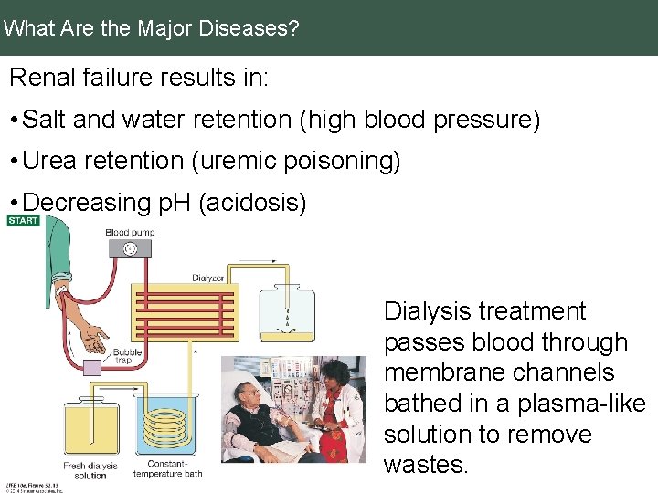 What Are the Major Diseases? Renal failure results in: • Salt and water retention