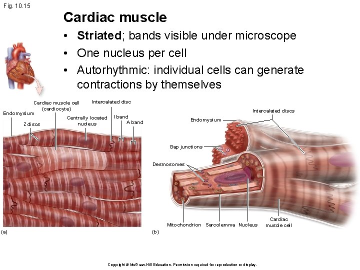 Fig. 10. 15 Cardiac muscle • Striated; bands visible under microscope • One nucleus