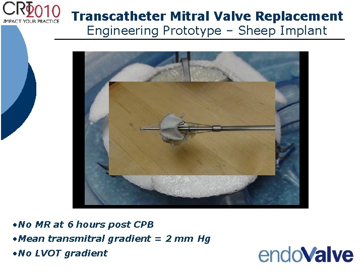 Transcatheter Mitral Valve Replacement Engineering Prototype – Sheep Implant • No MR at 6 Transcatheter Mitral Valve Replacement Engineering Prototype – Sheep Implant • No MR at 6