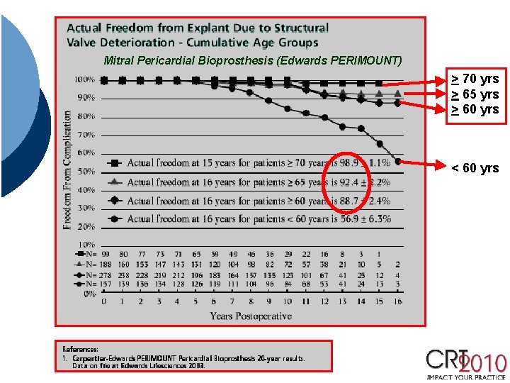 Mitral Pericardial Bioprosthesis (Edwards PERIMOUNT) > 70 yrs > 65 yrs > 60 yrs Mitral Pericardial Bioprosthesis (Edwards PERIMOUNT) > 70 yrs > 65 yrs > 60 yrs
