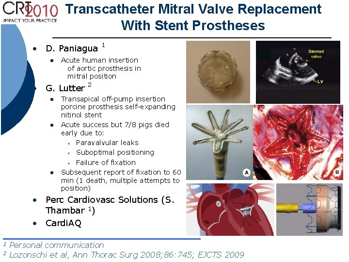 Transcatheter Mitral Valve Replacement With Stent Prostheses • D. Paniagua l Acute human insertion Transcatheter Mitral Valve Replacement With Stent Prostheses • D. Paniagua l Acute human insertion