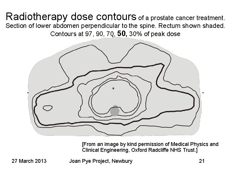 Radiotherapy dose contours of a prostate cancer treatment. Section of lower abdomen perpendicular to Radiotherapy dose contours of a prostate cancer treatment. Section of lower abdomen perpendicular to