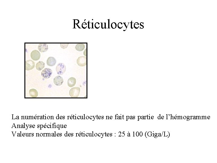 Réticulocytes La numération des réticulocytes ne fait pas partie de l’hémogramme Analyse spécifique Valeurs