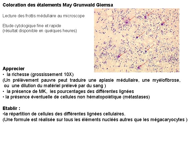 Coloration des étalements May Grunwald Giemsa Lecture des frottis médullaire au microscope Etude cytologique