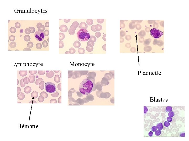 Granulocytes Lymphocyte Monocyte Plaquette Blastes Hématie 