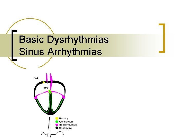 Basic Dysrhythmias Sinus Arrhythmias 