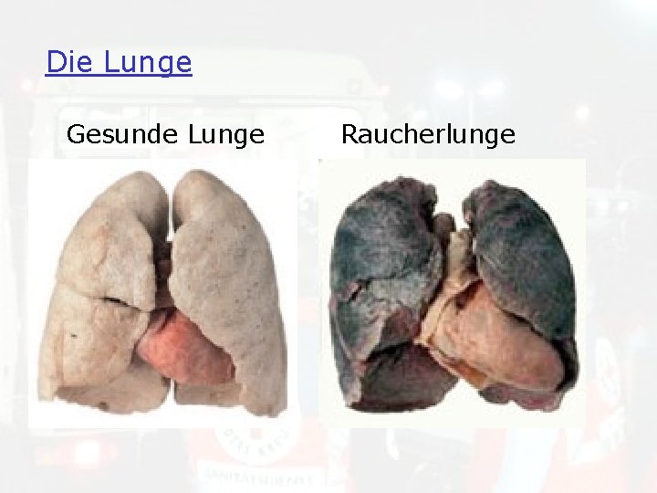 Die Lunge Gesunde Lunge Raucherlunge 
