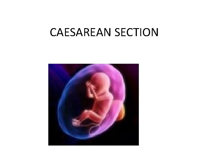 CAESAREAN SECTION - 