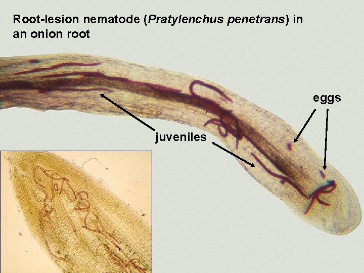 Root-lesion nematode (Pratylenchus penetrans) in an onion root eggs juveniles 