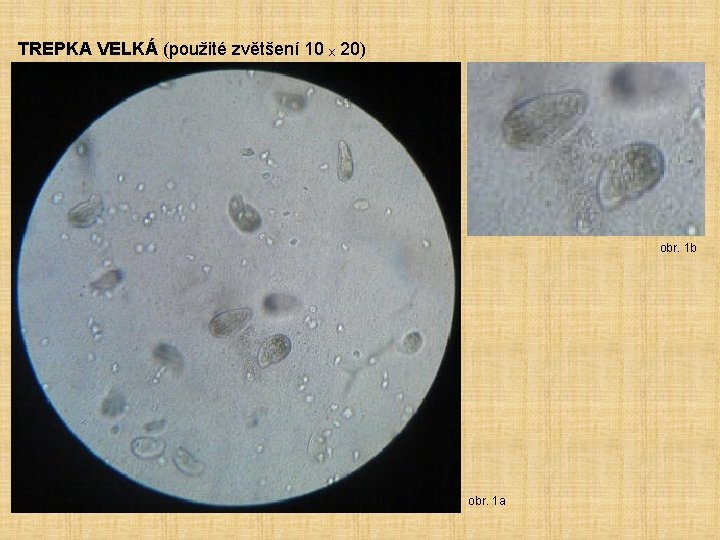 TREPKA VELKÁ (použité zvětšení 10 ₓ 20) obr. 1 b obr. 1 a 