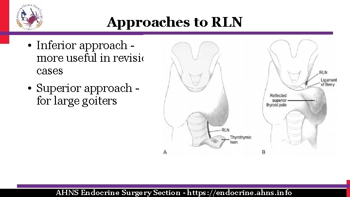 Approaches to RLN • Inferior approach more useful in revision cases • Superior approach