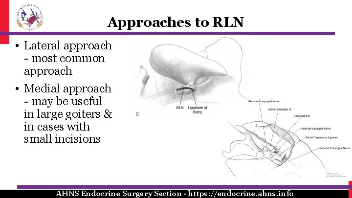 Approaches to RLN • Lateral approach - most common approach • Medial approach -