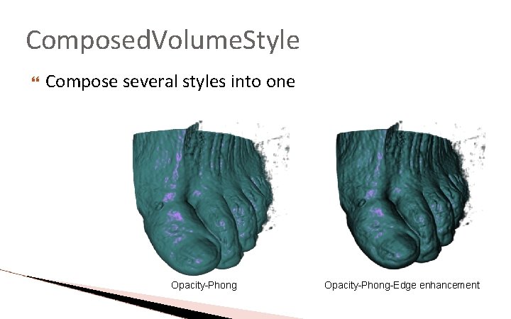 Composed. Volume. Style Compose several styles into one Opacity-Phong-Edge enhancement Composed. Volume. Style Compose several styles into one Opacity-Phong-Edge enhancement