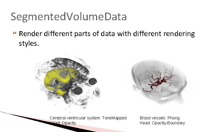Segmented. Volume. Data Render different parts of data with different rendering styles. Cerebral ventricular Segmented. Volume. Data Render different parts of data with different rendering styles. Cerebral ventricular