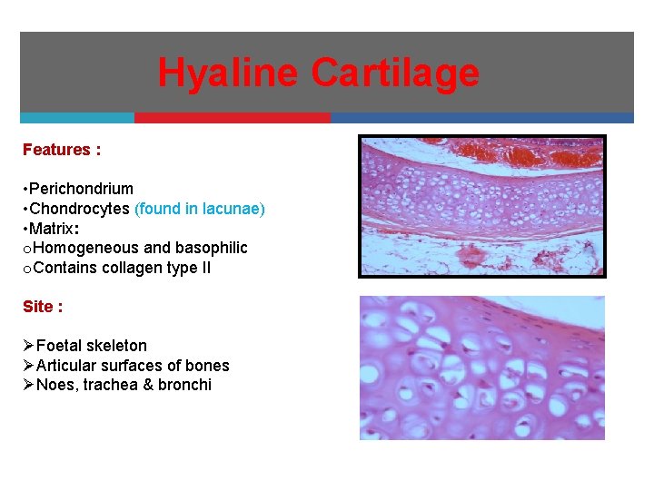 Hyaline Cartilage Features : • Perichondrium • Chondrocytes (found in lacunae) • Matrix: o.