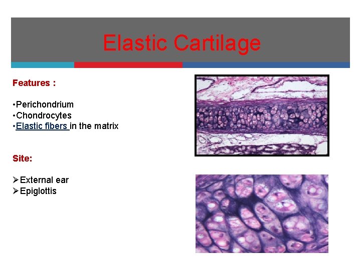Elastic Cartilage Features : • Perichondrium • Chondrocytes • Elastic fibers in the matrix