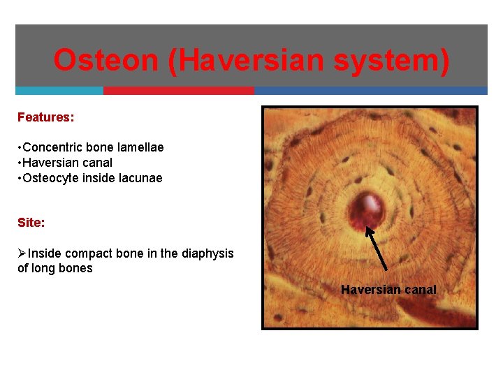 Osteon (Haversian system) Features: • Concentric bone lamellae • Haversian canal • Osteocyte inside