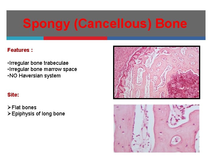 Spongy (Cancellous) Bone Features : • Irregular bone trabeculae • Irregular bone marrow space