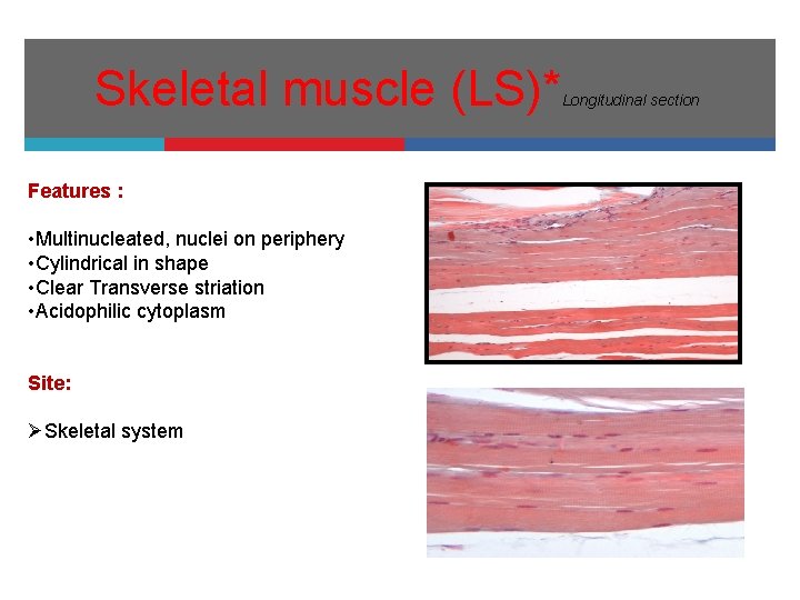 Skeletal muscle (LS)* Features : • Multinucleated, nuclei on periphery • Cylindrical in shape