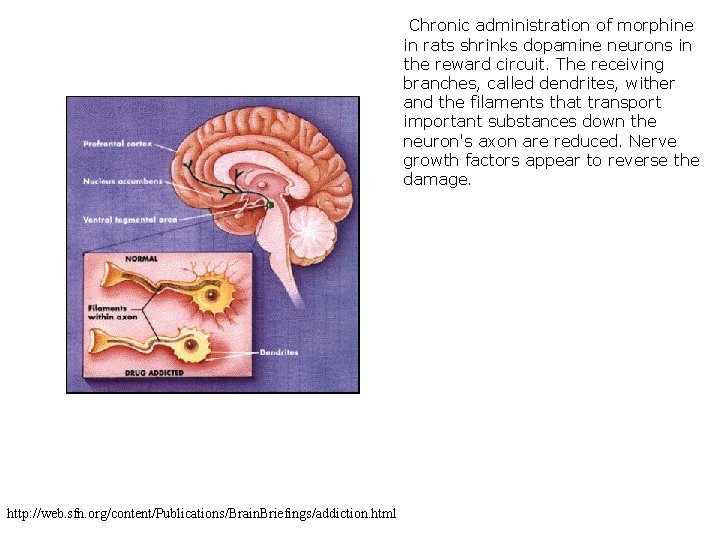 Chronic administration of morphine in rats shrinks dopamine neurons in the reward circuit. The