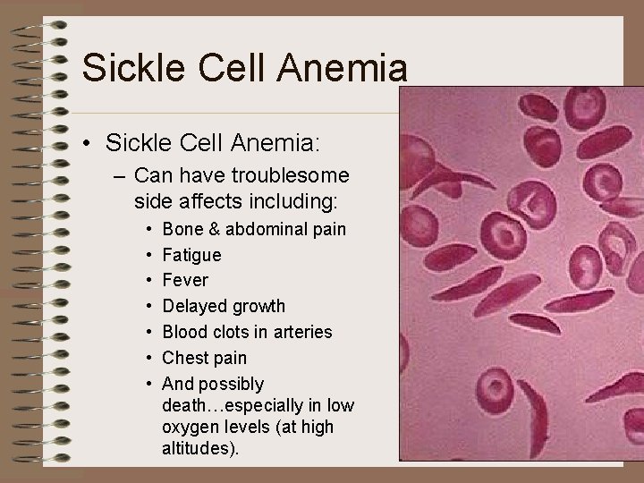 Sickle Cell Anemia • Sickle Cell Anemia: – Can have troublesome side affects including: