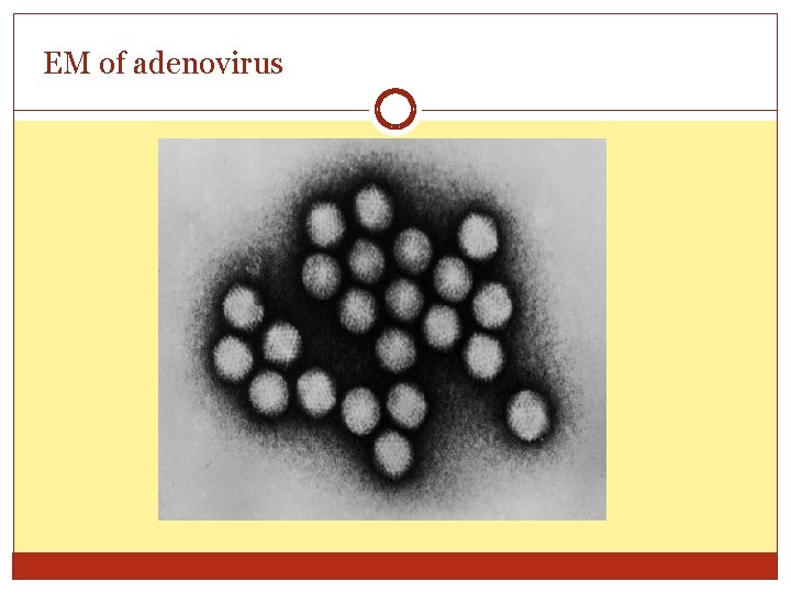 EM of adenovirus 