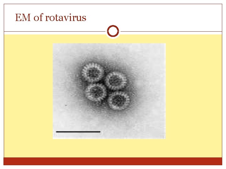 EM of rotavirus 