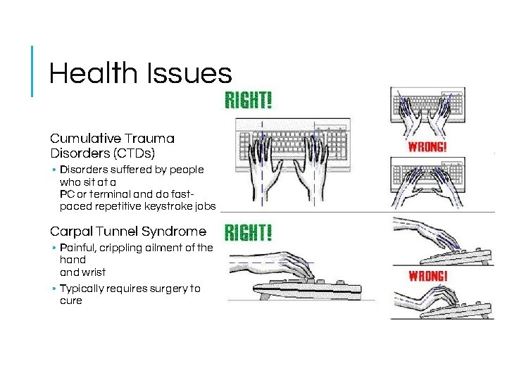 Health Issues Cumulative Trauma Disorders (CTDs) • Disorders suffered by people who sit at Health Issues Cumulative Trauma Disorders (CTDs) • Disorders suffered by people who sit at