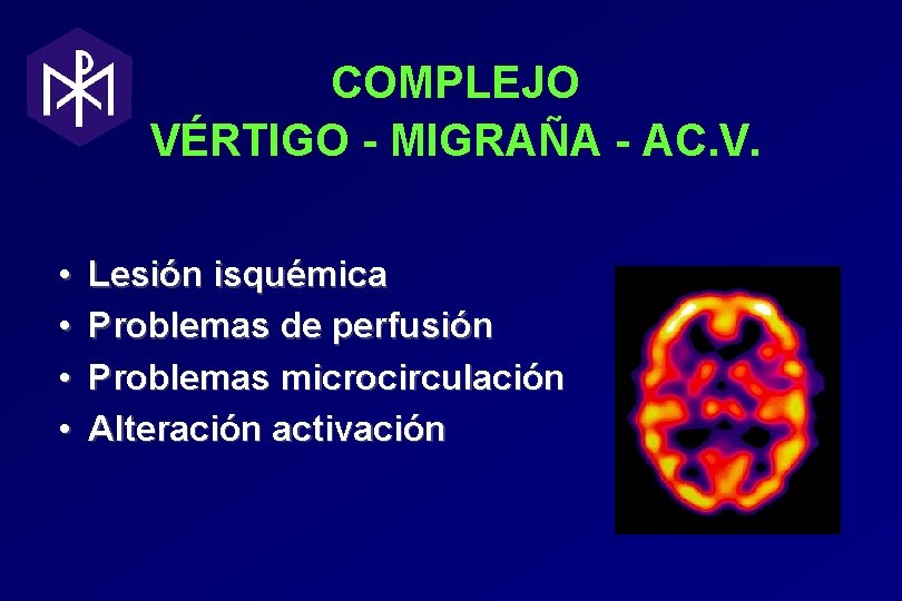 COMPLEJO VÉRTIGO - MIGRAÑA - AC. V. • • Lesión isquémica Problemas de perfusión COMPLEJO VÉRTIGO - MIGRAÑA - AC. V. • • Lesión isquémica Problemas de perfusión