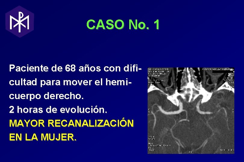 CASO No. 1 Paciente de 68 años con dificultad para mover el hemicuerpo derecho. CASO No. 1 Paciente de 68 años con dificultad para mover el hemicuerpo derecho.