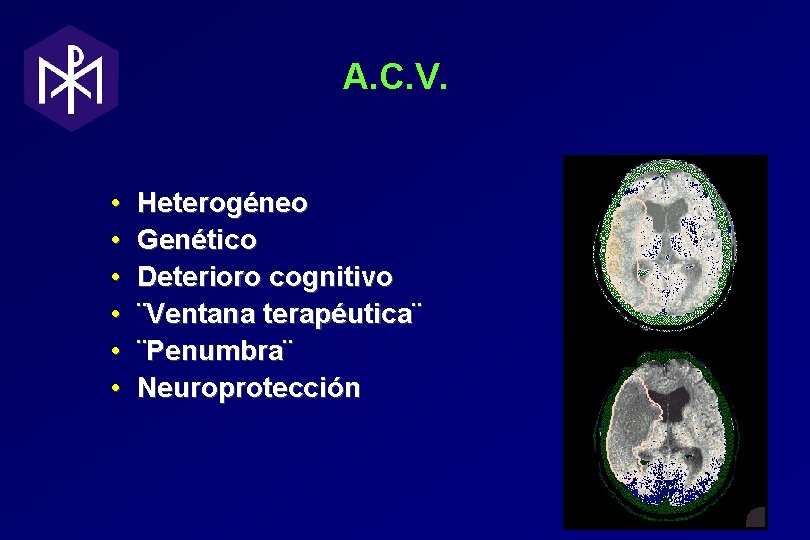 A. C. V. • • • Heterogéneo Genético Deterioro cognitivo ¨Ventana terapéutica¨ ¨Penumbra¨ Neuroprotección A. C. V. • • • Heterogéneo Genético Deterioro cognitivo ¨Ventana terapéutica¨ ¨Penumbra¨ Neuroprotección