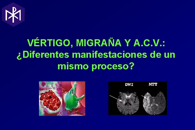 VÉRTIGO, MIGRAÑA Y A. C. V. : ¿Diferentes manifestaciones de un mismo proceso? VÉRTIGO, MIGRAÑA Y A. C. V. : ¿Diferentes manifestaciones de un mismo proceso?