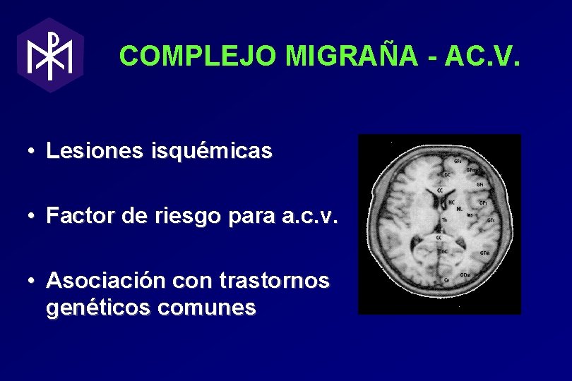 COMPLEJO MIGRAÑA - AC. V. • Lesiones isquémicas • Factor de riesgo para a. COMPLEJO MIGRAÑA - AC. V. • Lesiones isquémicas • Factor de riesgo para a.