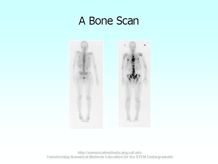 A Bone Scan http: //numericalmethods. eng. usf. edu Transforming Numerical Methods Education for the A Bone Scan http: //numericalmethods. eng. usf. edu Transforming Numerical Methods Education for the