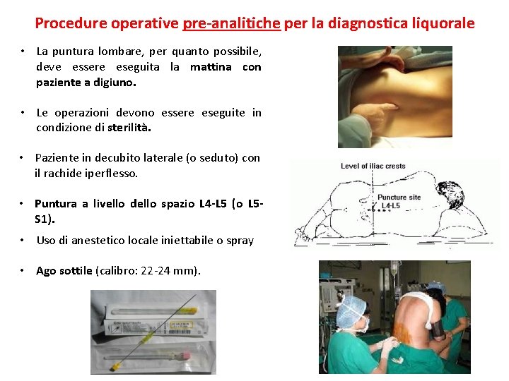 Procedure operative pre-analitiche per la diagnostica liquorale • La puntura lombare, per quanto possibile,