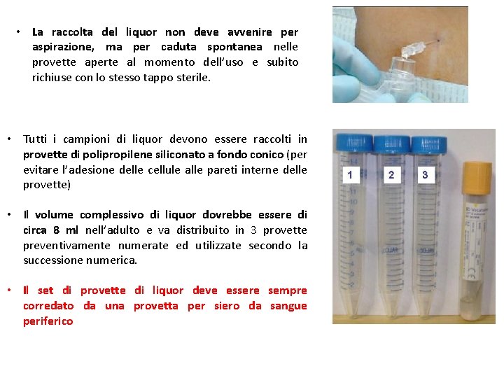  • La raccolta del liquor non deve avvenire per aspirazione, ma per caduta