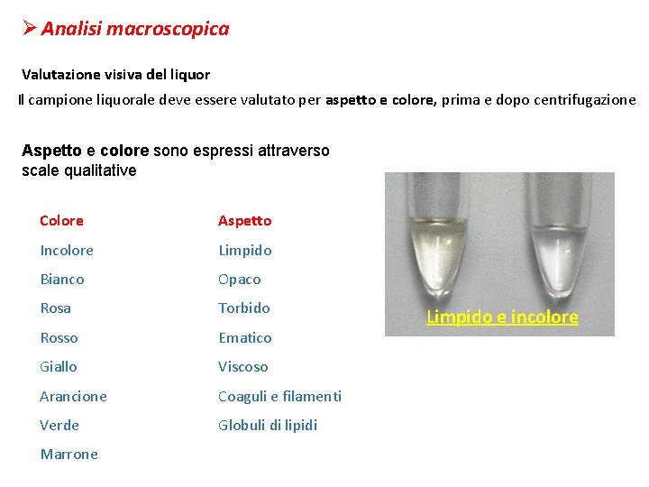 Ø Analisi macroscopica Valutazione visiva del liquor Il campione liquorale deve essere valutato per