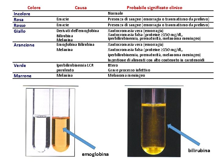 Colore Incolore Rosa Rosso Giallo Arancione Verde Marrone Causa Emazie Derivati dell’emoglobina Bilirubina Melanina