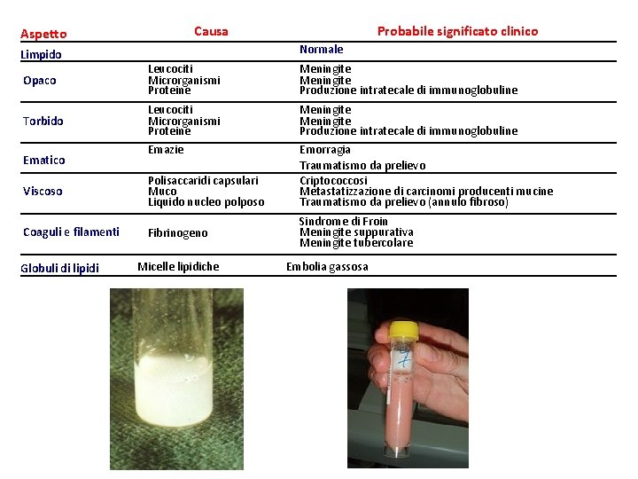  Aspetto Limpido Opaco Torbido Ematico Viscoso Coaguli e filamenti Globuli di lipidi Causa