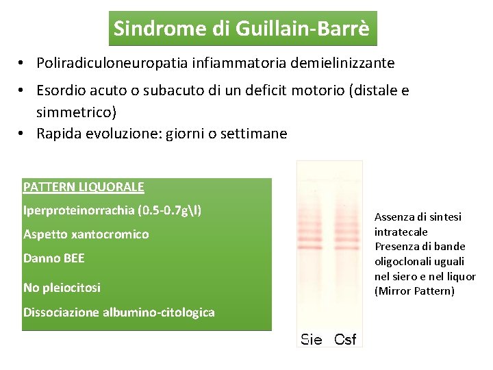 Sindrome di Guillain-Barrè • Poliradiculoneuropatia infiammatoria demielinizzante • Esordio acuto o subacuto di un