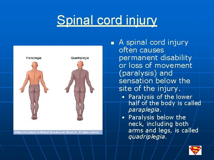 Spinal cord injury n A spinal cord injury often causes permanent disability or loss