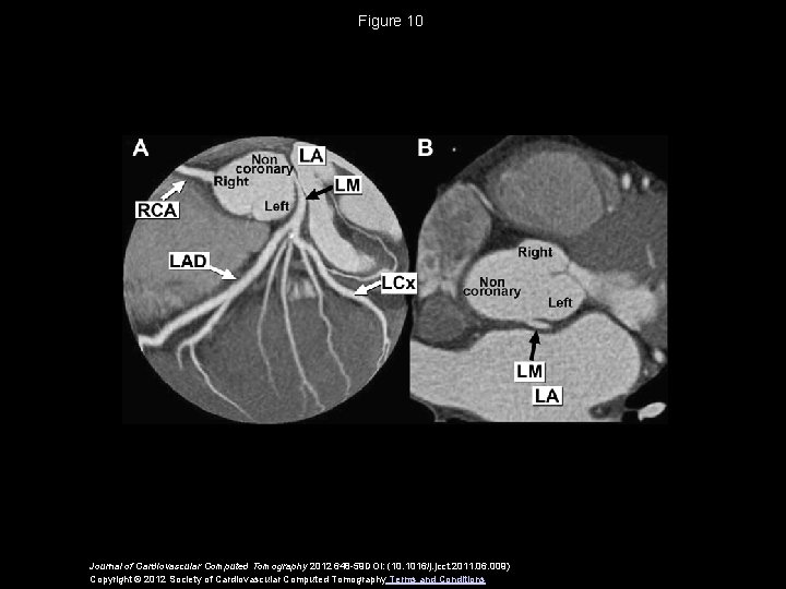 Figure 10 Journal of Cardiovascular Computed Tomography 2012 648 -59 DOI: (10. 1016/j. jcct.