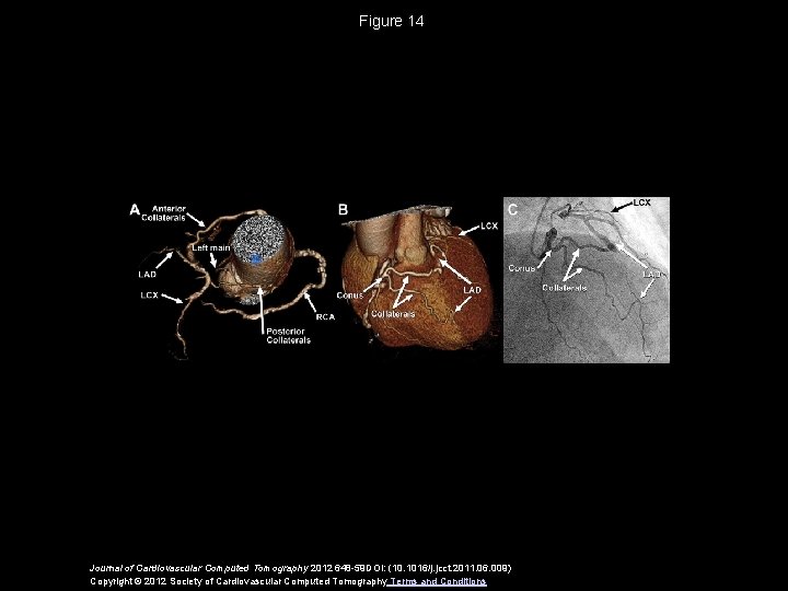 Figure 14 Journal of Cardiovascular Computed Tomography 2012 648 -59 DOI: (10. 1016/j. jcct.